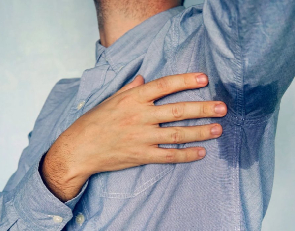 Campaña de simpatectomía en Arequipa: solución definitiva para la hiperhidrosis