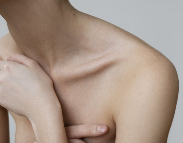 Cirugía para Pectus Carinatum: la solución definitiva para corregir el pecho salido