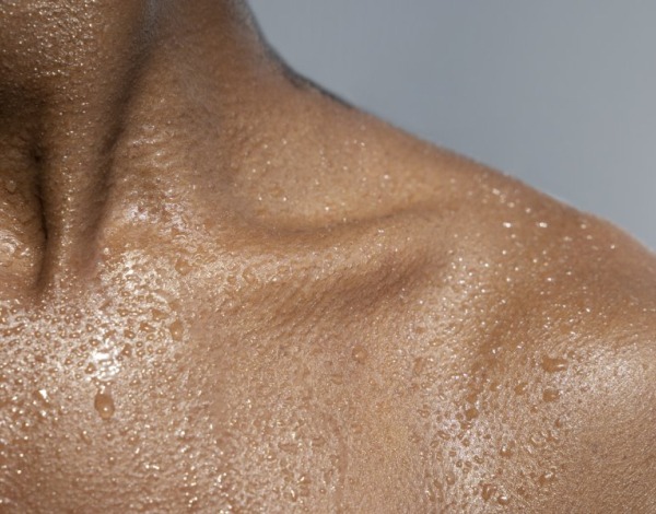 ¿La sudoración excesiva afecta tu vida? La hiperhidrosis tiene solución definitiva