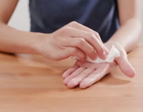 Sudoración Excesiva: Posibles Causas y Tratamiento