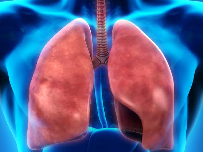 Tumores de mediastino