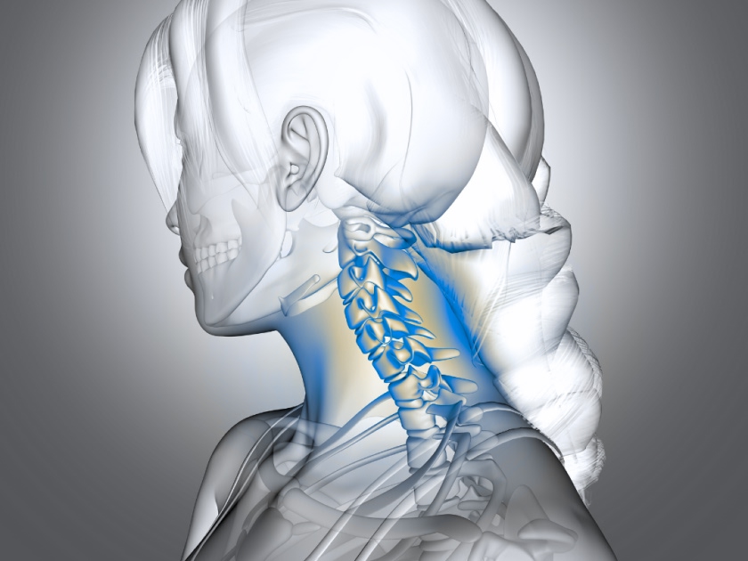 Estenosis traqueal y subglótica