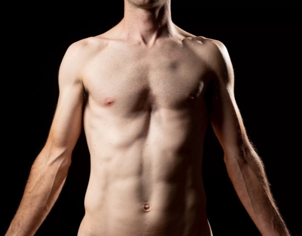 Pectus Excavatum o Pecho hundido