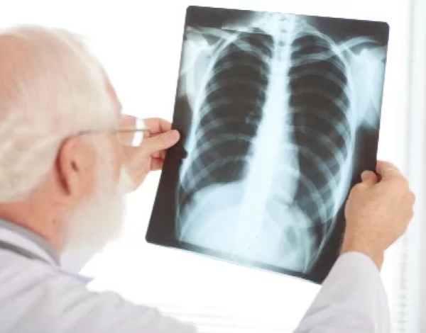 El tratamiento para el Rubor facial patológico es la cirugía