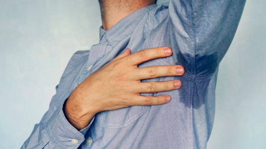 Campaña de simpatectomía en Arequipa: solución definitiva para la hiperhidrosis