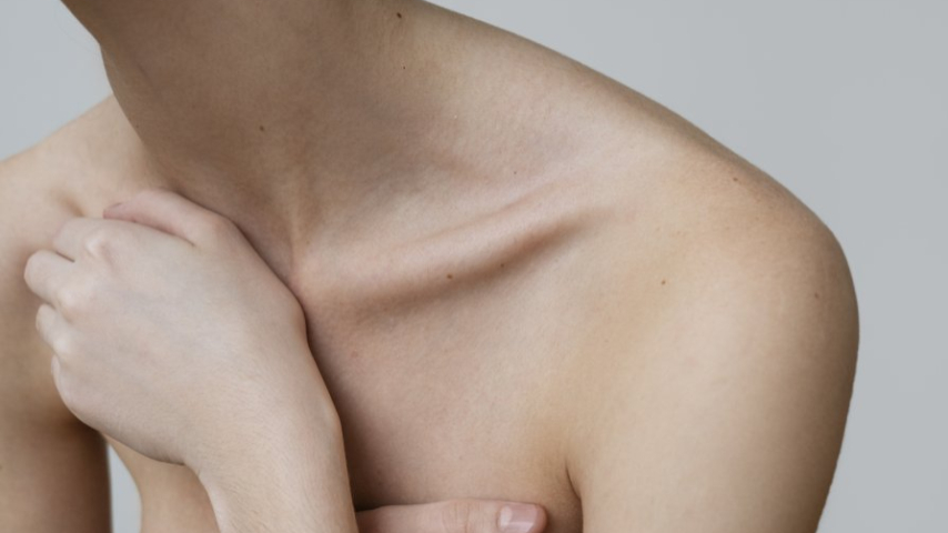Cirugía para Pectus Carinatum: la solución definitiva para corregir el pecho salido