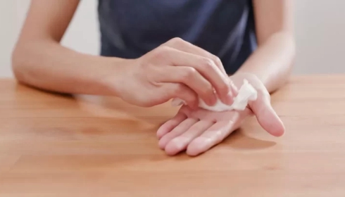 Sudoración Excesiva: Posibles Causas y Tratamiento