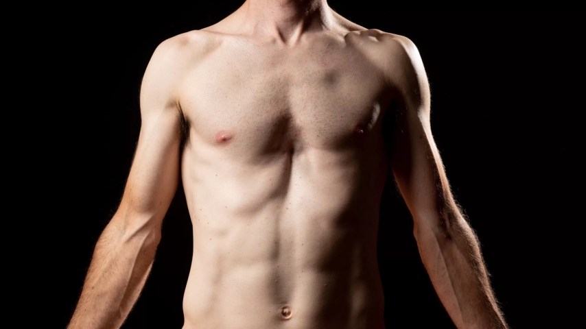 Pectus Excavatum o Pecho hundido