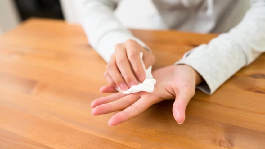 Hiperhidrosis palmar