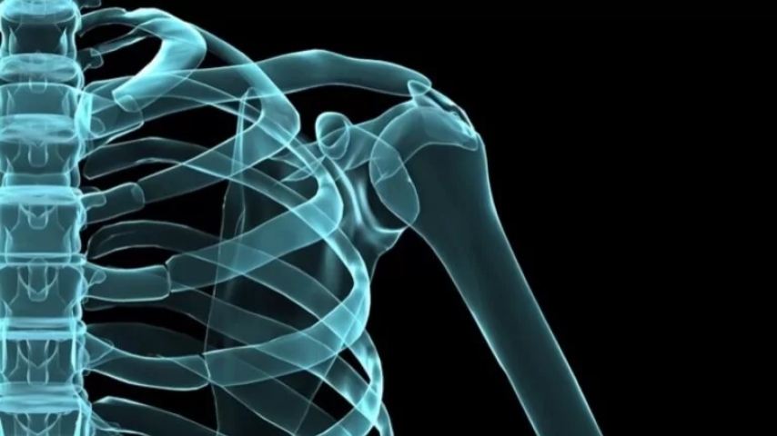 Cirugía para cáncer de pulmón menos invasiva