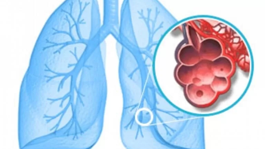 Cáncer de pulmón y las nuevas terapias