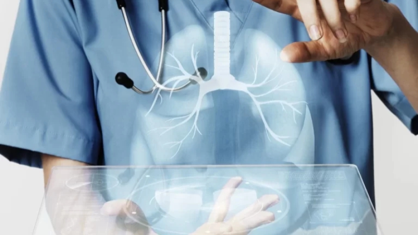 Técnicas que revolucionan la cirugía torácica, acortando el tiempo del alta médica