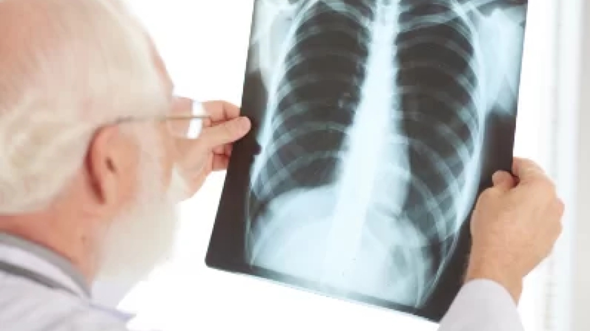 El tratamiento para el Rubor facial patológico es la cirugía