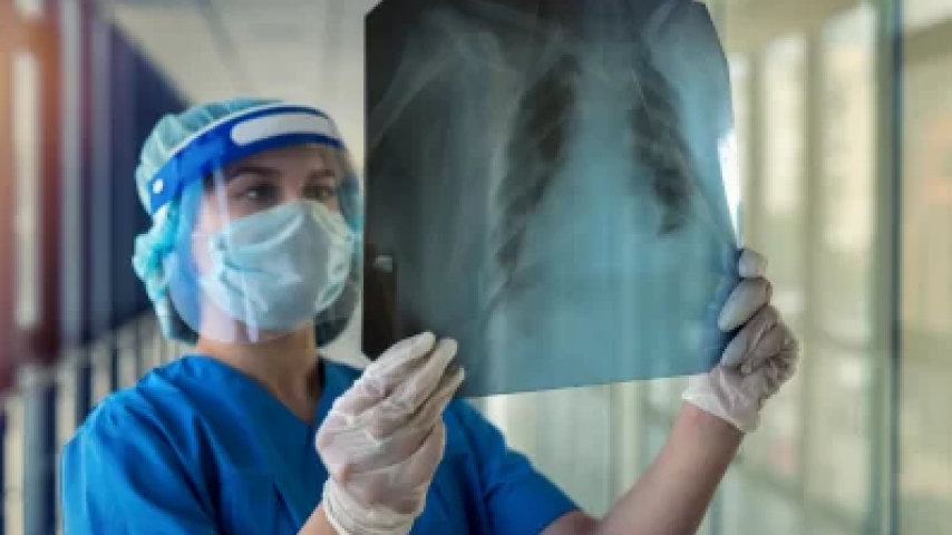 Simpatectomía toracoscópica: una revisión de la literatura