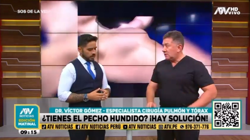 Deformidades congénitas del pecho: explicación del Dr. Víctor Gómez en ATV Noticias