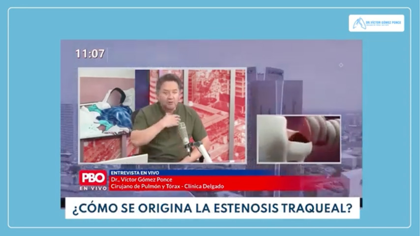 El Dr. Víctor Gómez explica el origen de la estenosis traqueal en entrevista para PBO Digital