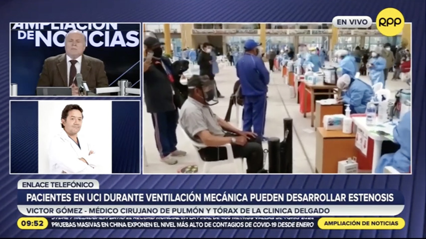 Pacientes UCI con ventilación mecánica puede desarrollar Estenosis Traqueal – Programa Ampliación de noticia – RPP